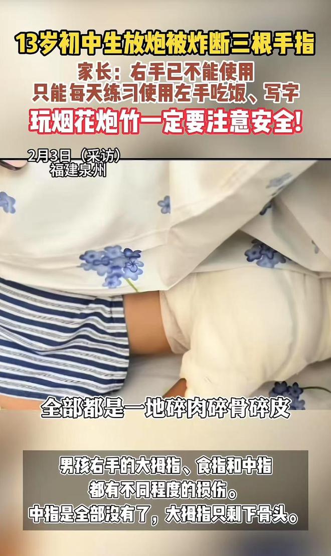 13岁男孩玩炮炸断三根手指网友：真是害苦了那些良心厂家(图1)